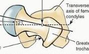 Angles of the femur: Angle of inclination; The femur is bent so that the long axis of the head and neck lies at an angle of about 125 O to that of the shaft.