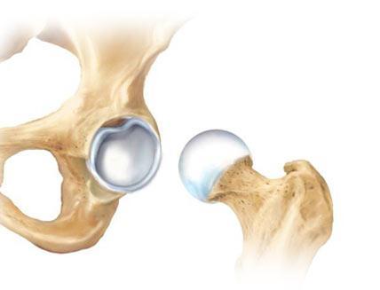 property, a rim of the acetabulum is raised slightly by an acetabular