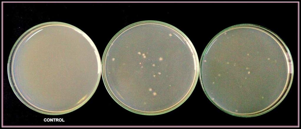 The isolated microorganisms were inoculated in VP broth. All the inoculated control tubes were incubated at 37 o C for 24-48 hours.