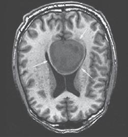 es representing the advanced imaging techniques that are increasingly used in brain research.