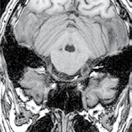 However, all scans with abnormalities detected on initial review were reviewed again by two neuroradiologists.