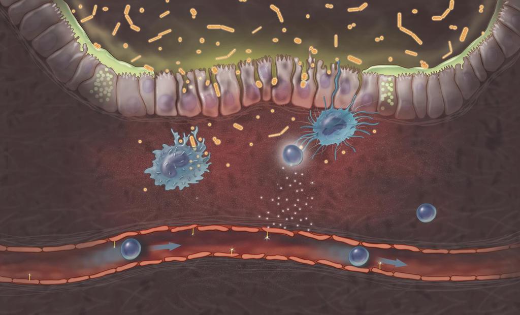 Inflammatory Bowel Disease Reflects an Imbalance of Inflammatory Response Disrupted Protective Mucus Layer Dendritic cells present antigen 2 1 Dendritic cells sample luminal bacteria 3