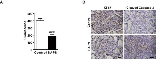 Figure S9. LOX confers to Lkb1 deficient tumor progression. (A) Detection of LOX serum activity from Kras, Lkb1 L/L mice treated with BAPN or saline (8 mice each group).