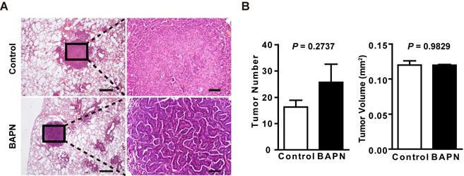 Figure S10. LOX inhibition does not significantly affect the progression of mouse lung tumors with wildtype Lkb1. (A) BAPN treatment had no effect on the size of Kras murine lung tumors.