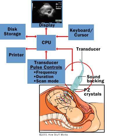 Principle of ultrasound Medical ultrasound imaging is ultrasound that is converted to an image Diagnostic Medical applications in use since late 1950 s Frequency ranges used in medical ultrasound