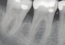 4 Are all forms of periodontal diseases the same? There are many types of periodontal diseases.