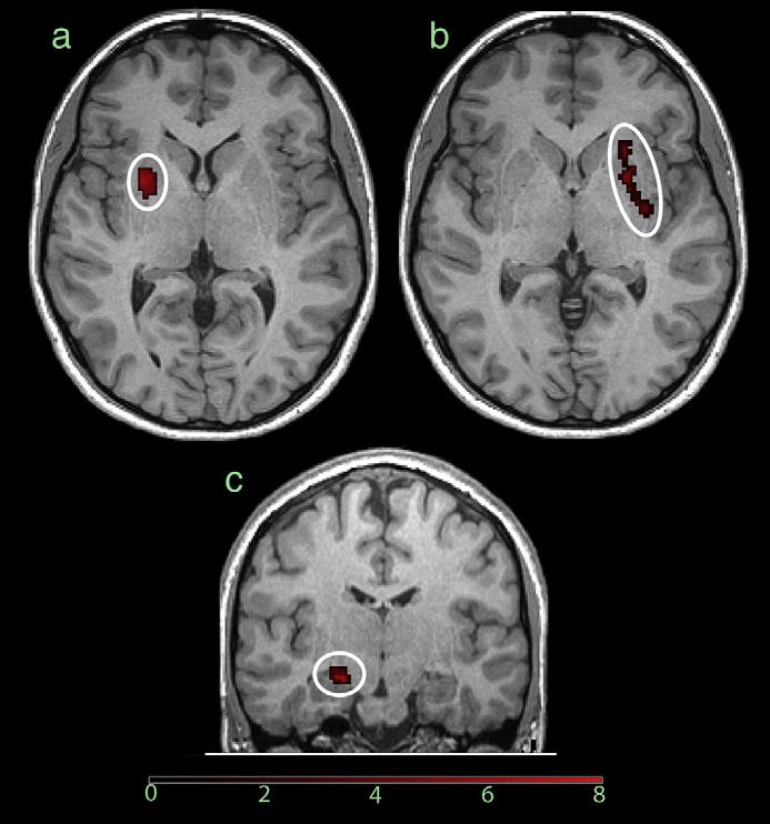 (a) Left parahippocampus ( 28, 44, 8). (b) Right parahippocampus (30, 26, 16). (c) Right hippocampus (36, 22, 8). Between-participant performance effects Recent fmri studies (Epstein et al.