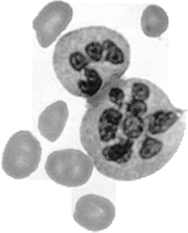 Hypersegmented neutrophils (contains five or more nuclear lobes) Hypersegmented Neutrophils 5 or 6 or more lobes or nuclear segmentation.