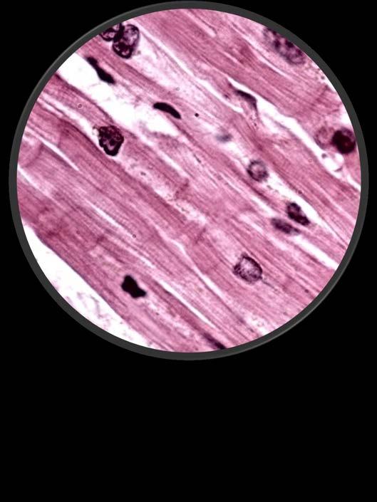 Cardiac Muscle Nuclei 400X (High Power) Striations cannot be easily seen at this