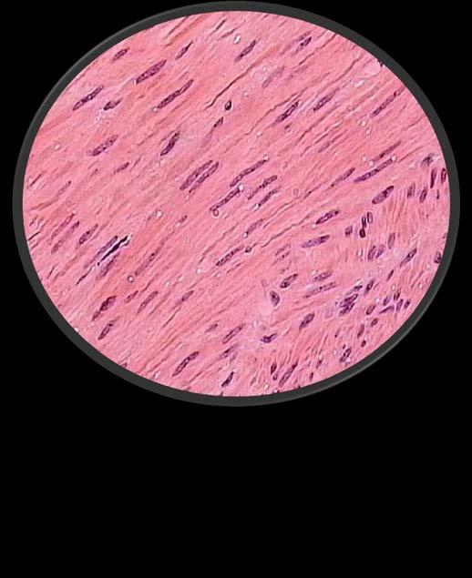 Smooth Muscle Nuclei 400X (High Power) The muscles of the esophagus, stomach, intestines and other internal organs Involuntary (you cannot control them)