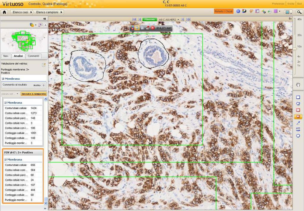 Image analysis application Two pathologists employed the software to select and outline
