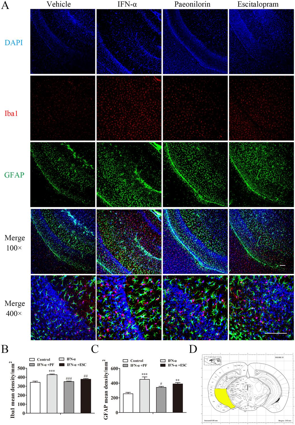 Figure 8: Paeoniflorin reduced interferon (IFN)-α-induced neuroinflammation in the ventral hippocampus.