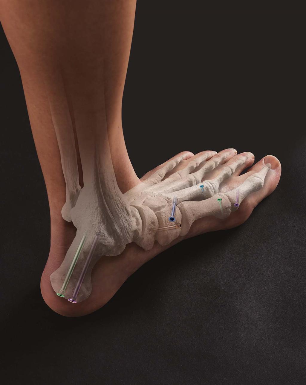 FOOT & ANKLE INTELLIGENTLY DESIGNED.