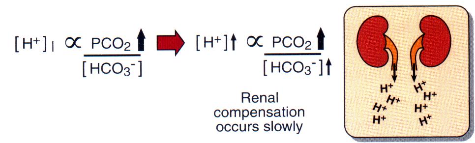 03 x PCO 2 Respiratory Acidosis