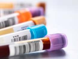 Tests for PCOS Blood tests: Your blood may be drawn to measure the levels of several hormones to exclude possible causes of menstrual abnormalities or androgen excess that mimic PCOS.