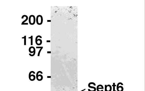 Figure S6. Subunit composition of the recombinant septin complex used for the assay.