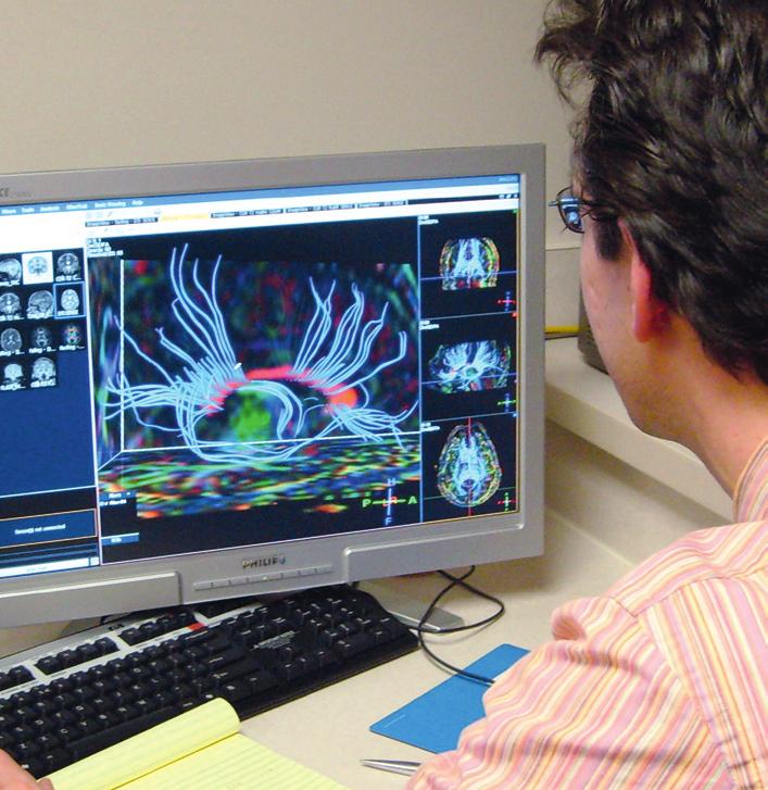 Seamless pre-surgical fmri and DTI mapping Newest release Achieva 3.