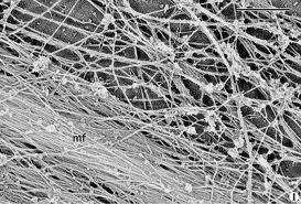 Microfilaments are Microfilaments Microfilaments also help cells to move.