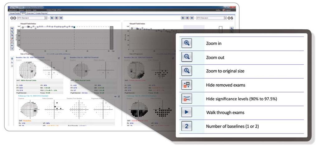 VFI Controls ZEISS FORUM Glaucoma Workplace enables you to modify the VFI plot display according to your preferences. VFI Bar To the right of the VFI Plot is the VFI Bar.