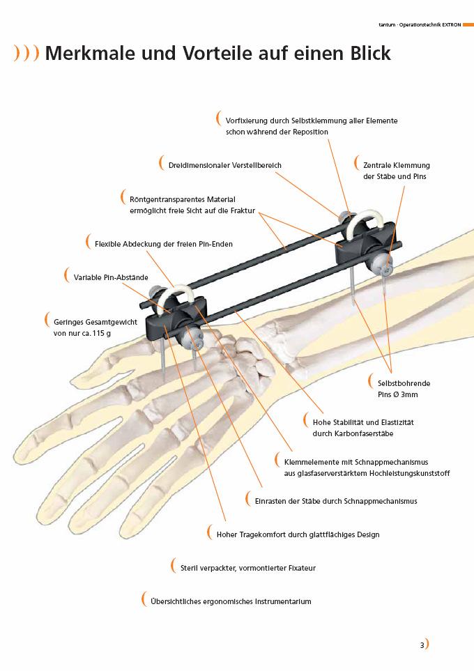 Features and Benefits at a glance Pre-fixation through self-clamping of all elements already during repositioning Three dimensional adjusting range Central clamping of rods and pins Radiolucent