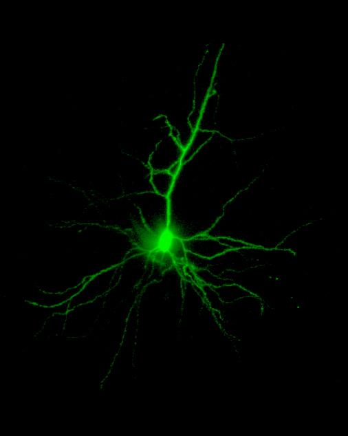A brief look at individual neurons in the brain Each of the