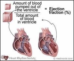 of the heart An echocardiogram is an