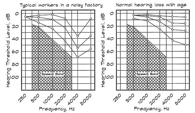 Hearing loss based on noise exposure and age adjustments
