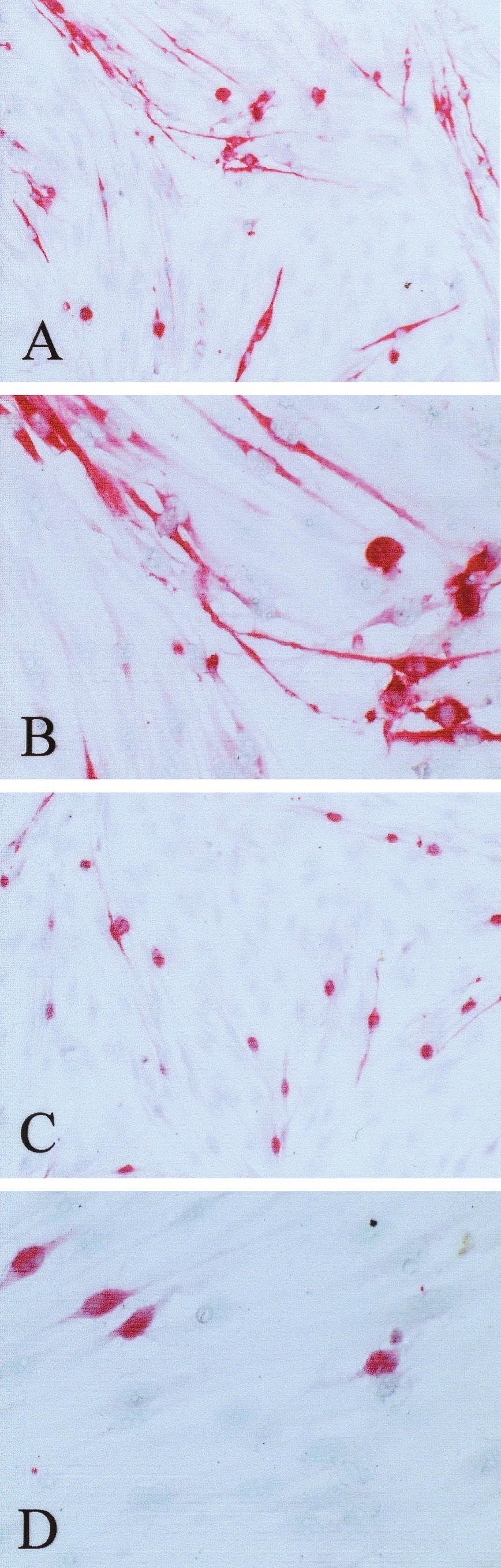 VOL. 75, 2001 ENDOTHELIAL CELL PLAQUE ASSAY FOR KSHV 5621 firmed that almost all spindle cells in late nodular KS lesions express LANA1.