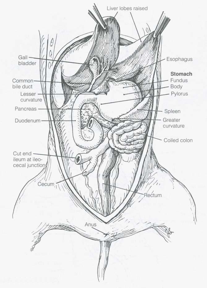 Ductus arteriosus: carries blood from pulmonary trunk to aorta (bypassing the non-functional lungs) o white and underneath apex of heart Umbilical arteries: carries waste-laden blood from pelvic