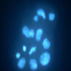 Aneuploid cells in a false