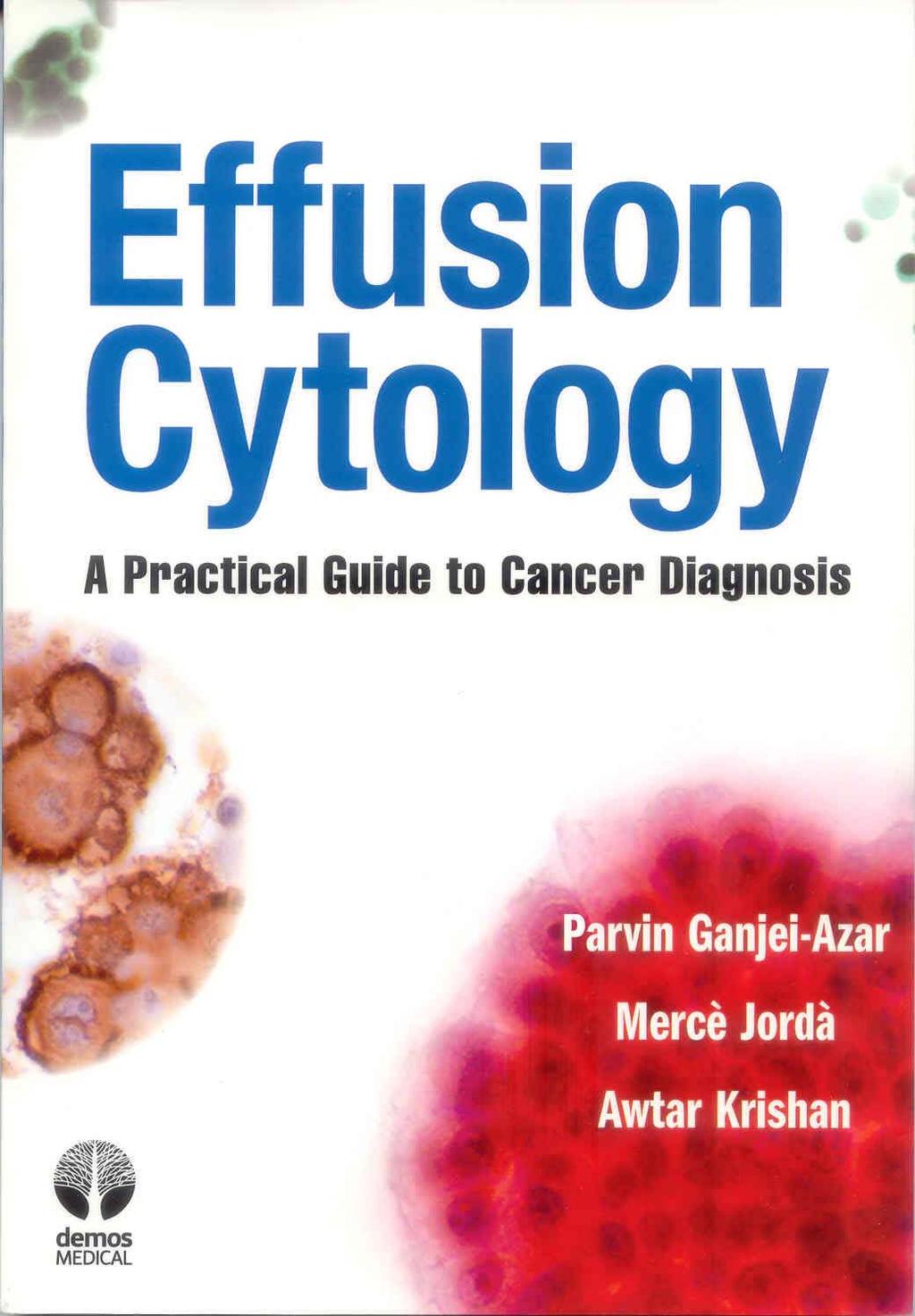 Diagnostic Cytology of Body Cavity Fluids Cellular patterns and morphological characteristics of the individual cells.