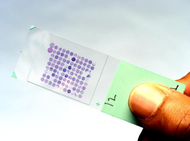 Use of Tissue micro array Whole slide: typically one (1) patient sample per slide TMA: Current method 25