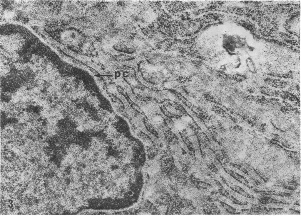 VOL. 61, 1968 BIOCHEMISTRY: MOLENAAR ET AL. 985 FIG. 3.-Jejunal epithelial cell of the same patient.