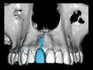 tal dental models scanned e.g.