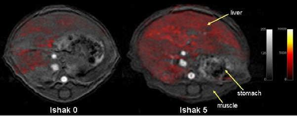 Molecular Imaging of Collagen DEC-MRI with EP-3533 contrast Fuchs BC et al.