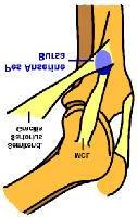 Palpation of the pes anserine bursa Goose s Foot Insertion of the conjoined tendons into the