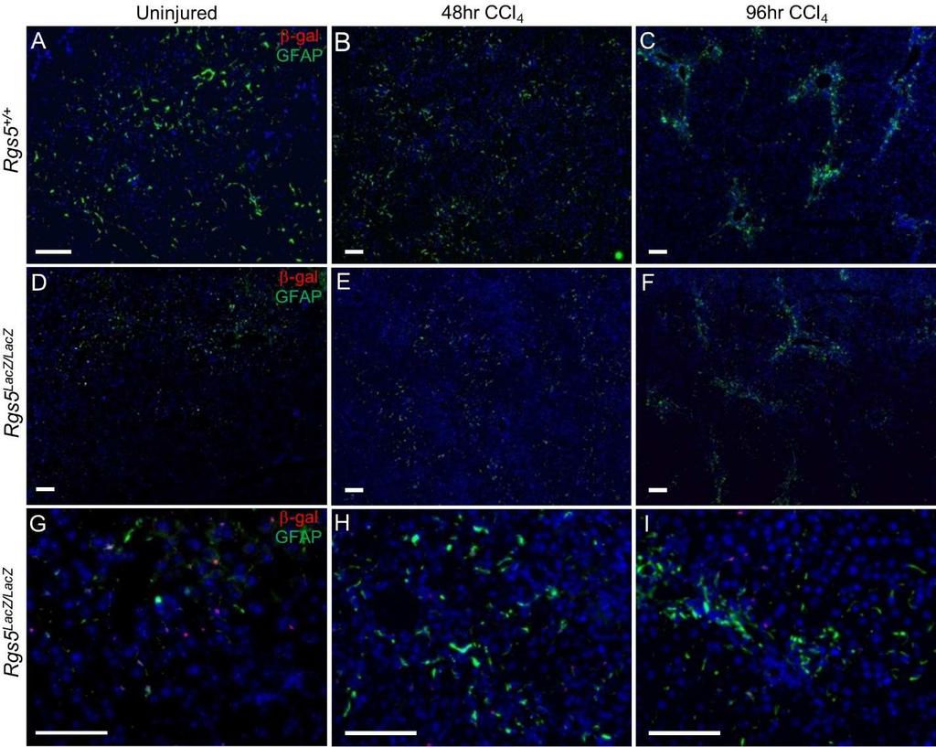 Figure 2.5 RGS5 + HSCs participate in the response to acute hepatic injury Anti-GFAP and anti-β-gal immunofluorescence were used to localize HSCs in acutely injured liver tissue. A-F.