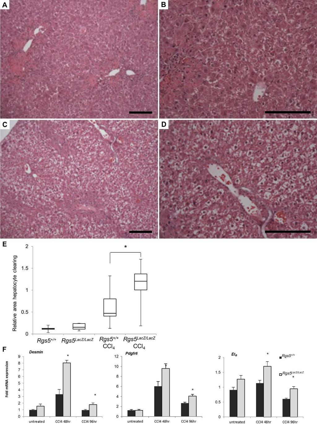 Figure 2.7 Rgs5 LacZ/LacZ mice have increased liver injury and HSC activation following acute injury Livers from Rgs5 +/+ and Rgs5 LacZ/LacZ were collected at 96hr following a single CCl 4 injection.