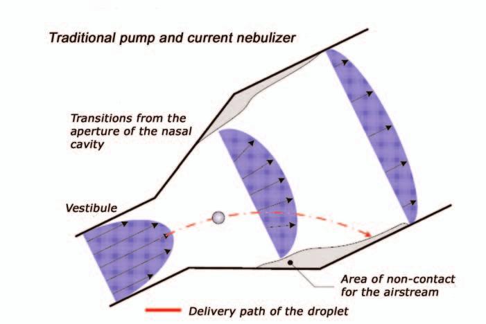 F I G U R E 2 Linear Flow Pattern of Traditional Passive Nebulizers F I G U R E 3 Deposition Pattern Produced by Passive Nebulizers TRADITIONAL NEBULIZERS LIMITED BY AIRFLOW PATTERNS Nebulizers were