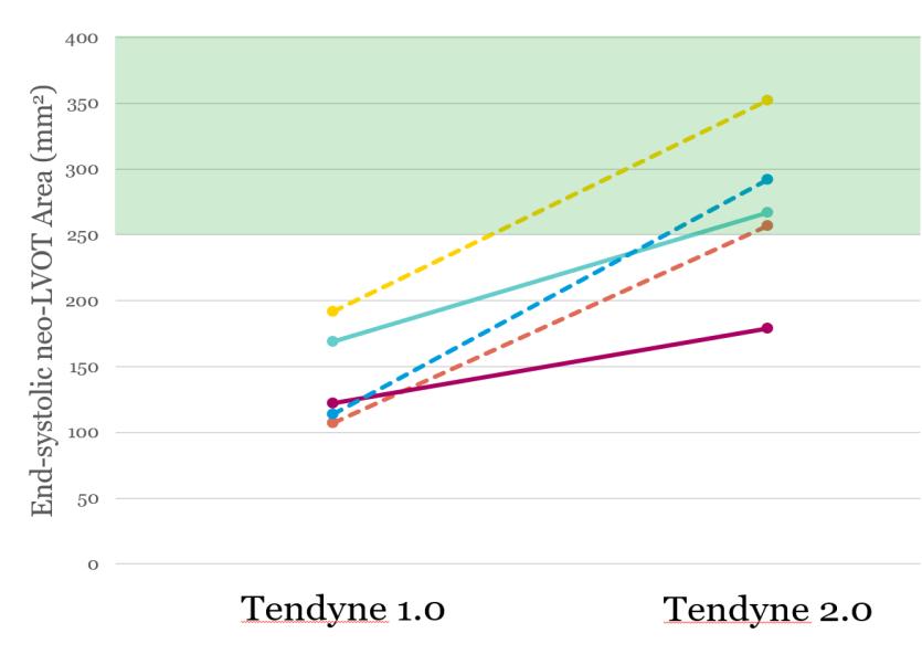 ~50% Tendyne LP valve (blue) Tendyne 1.