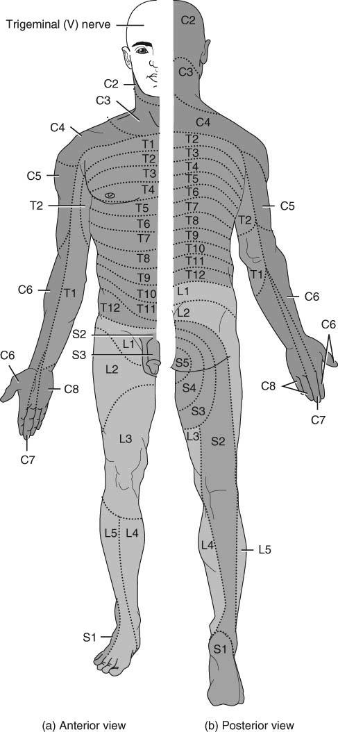 malfunctioning Skin on face supplied by Cranial Nerve V 29 30 Dermatomes Damaged regions of the spinal cord can be distinguished by patterns of numbness over a dermatome region Spinal cord