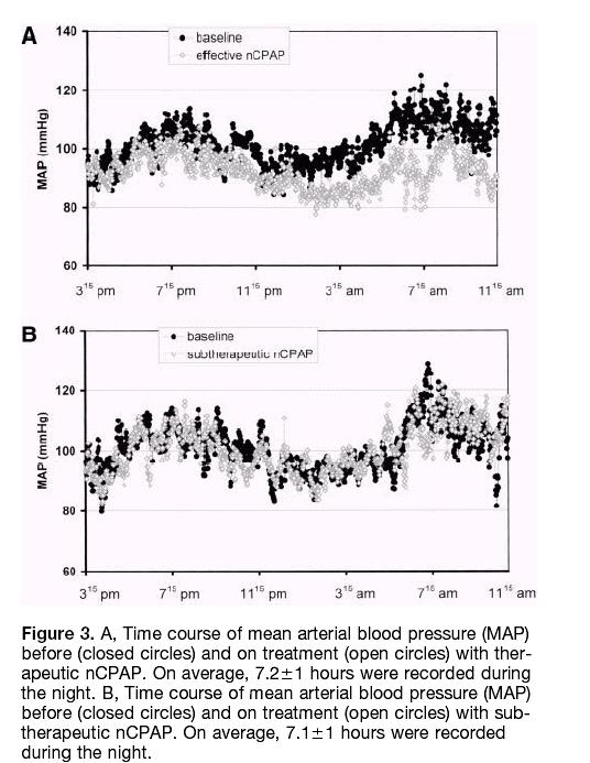CPAP Lowers BP in SDB 9 Weeks CPAP (n=16)