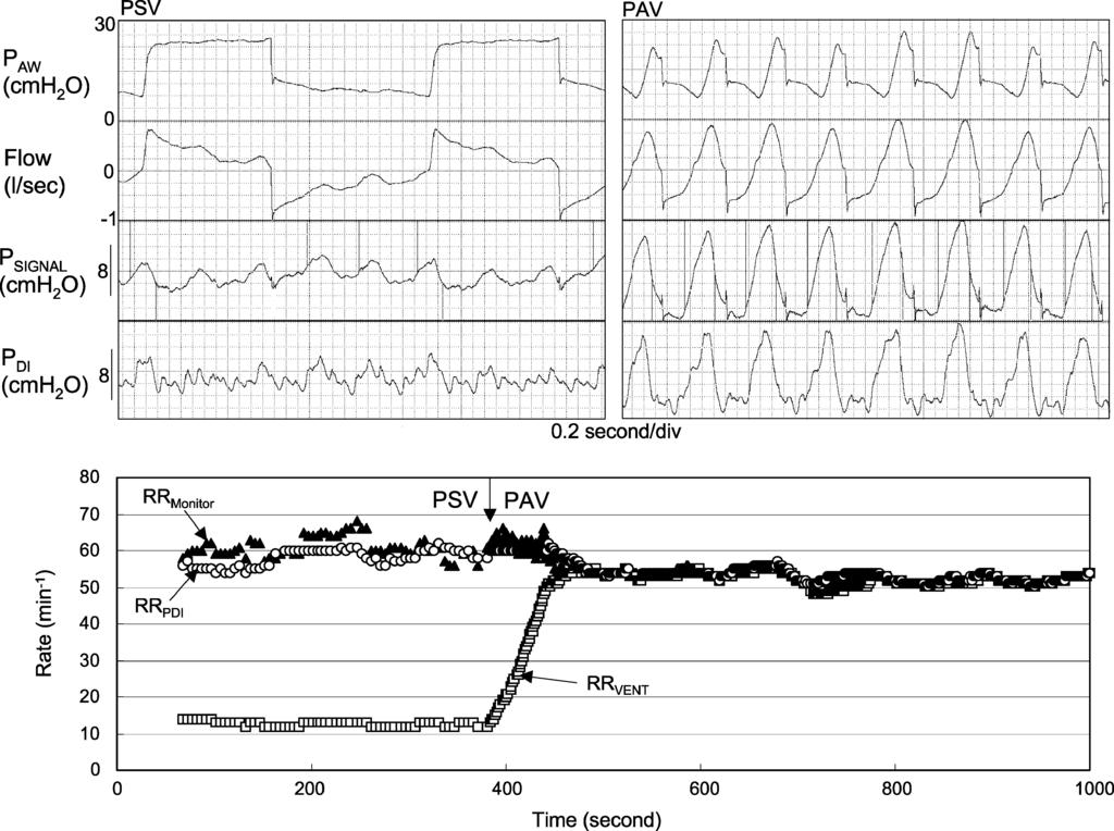 1344 Fig. S4, ESM). Ideally cycling-off should be linked to the rate of decline in P MUS and to RC.