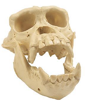 BONE STRUCTURE Bone: a type of