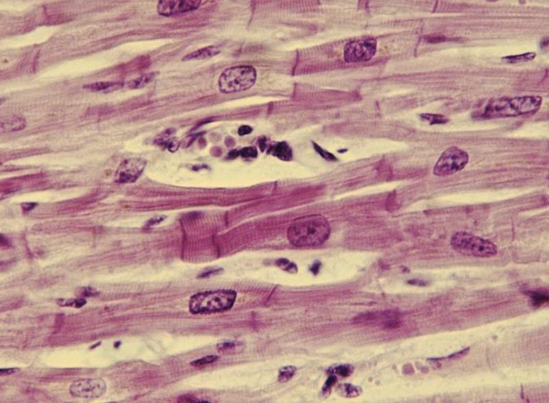 3. Cardiac Muscle: Found only in