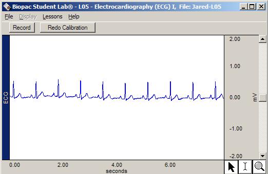 Lesson 5: ECG I Page 7 Fig. 5.7 If data resembles Fig. 5.7 (with allowance for any difference in vertical scaling), proceed to the Data Recording section.