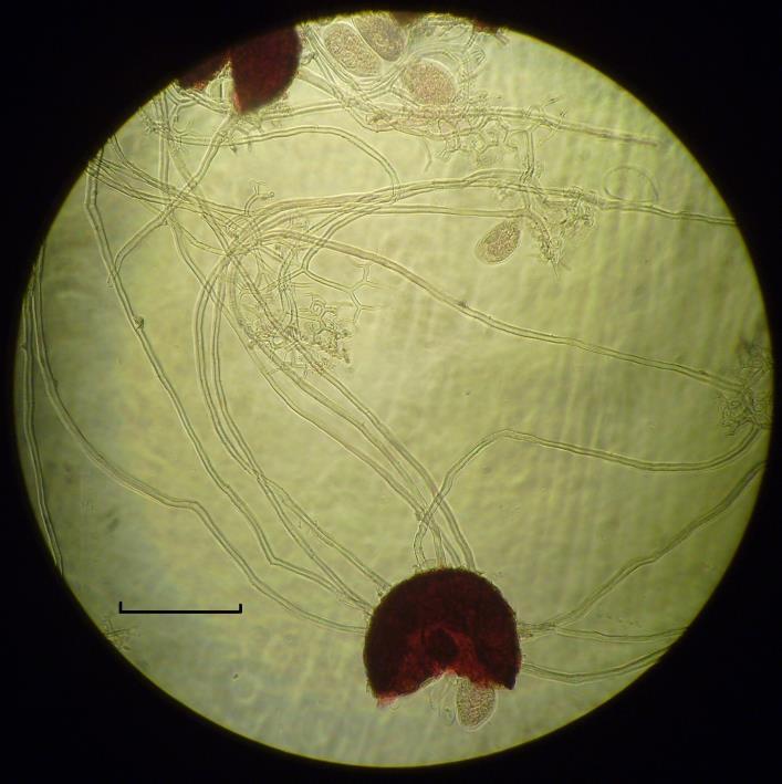 Fig. 2: Photomicrographs of chasmothecial appendages of
