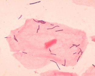 Lactobacilli Anaerobic, gram-positive bacteria Predominant bacteria found in genital flora of healthy, premenopausal