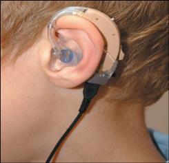Audiology Policy Hearing Aids/Radio Aids We promote and support good hearing