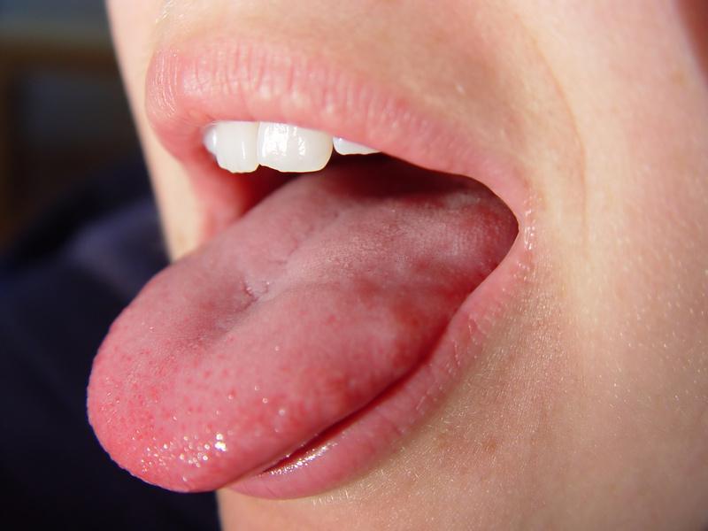 Tongue 3.
